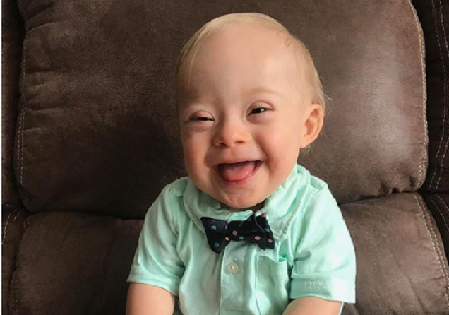 Fëmija me sindromën Down që sapo hyri në histori