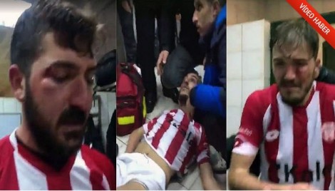 Tifozët rrahin futbollistët miq, 4 lojtarë përfundojnë në spital (VIDEO)