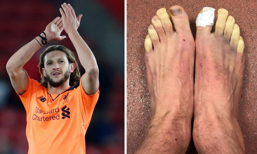 Lallana tregon gishtat e ngrirë të këmbëve