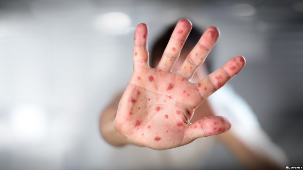 12-vjeçarja vdes nga fruthi, vëllai e motra me helikopter drejt Tiranës