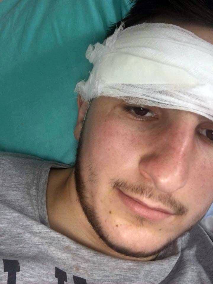 Apel për ndihmë për 19-vjeçarin nga Durrësi, rrezikon të mbetet i paralizuar (VIDEO)