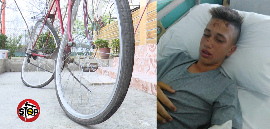 Aksidenti i rëndë i 13-vjeçarit nga Durrësi, shkarkohet mjeku