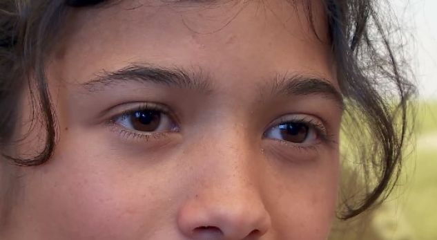 Një apel për të gjithë shqiptarët në ndihmë të 13-vjeçares që vuan nga sëmundja e rëndë