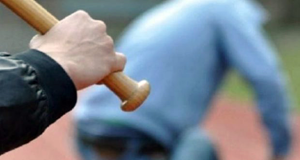 Dhunon rëndë babain, arrestohet 24-vjeçari