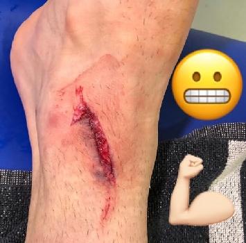 Mandzukic tregon plagët e “luftës”, një e çarë e thellë pranë kaviljes