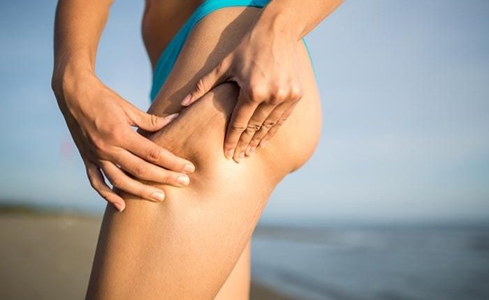 Plazhi lufton celulitin, zbuloni efektet dhe 6 këshilla praktike