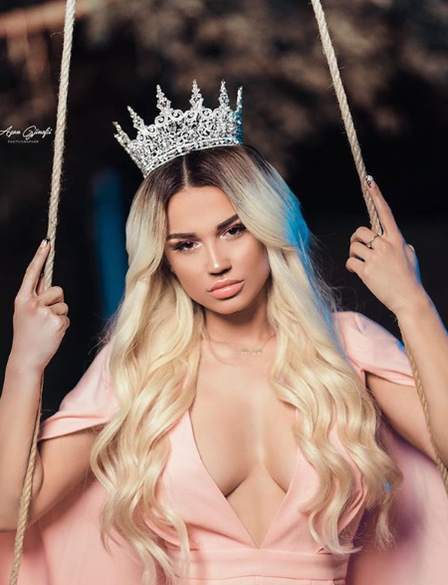 Këngëtaren shqiptare e dhunojnë në mes të rrugës, përfundon në spital (FOTO)