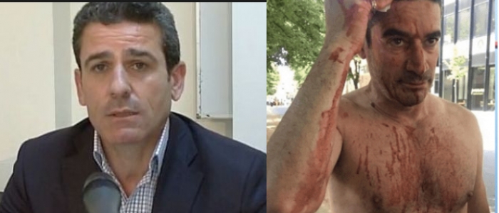 Pse nuk reagoi Unioni i Gazetarëve për Kasmin? Flet Çipa: U soll si militant partiak