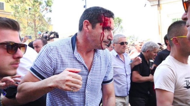 “Reporterët pa kufij”: Rama të dënojë publikisht përdorimin e dhunës ndaj gazetarit