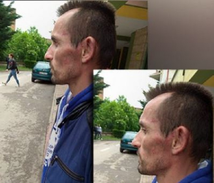 34-vjeçari tregon torturat e policisë: Grushte e shkelma në çdo pjesë të trupit. Ja pse dyshonin