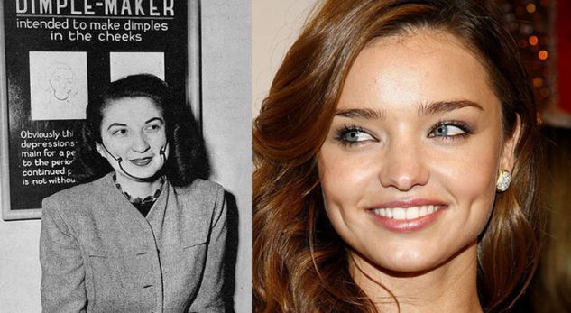 Përse disa njerëzve u shfaqen gropëza në faqe kur qeshin?!