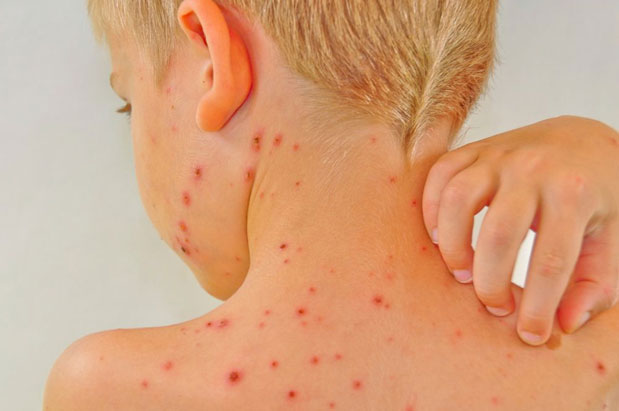 Mjeku infeksionist thirrje prindërve: Ndërgjegjësohuni, sot pashë skena &#8220;ulëritëse&#8221;