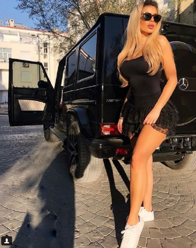 E akuzojnë për ndërhyrje në bel, Luana Vjollca tregon të vërtetën! (FOTO)