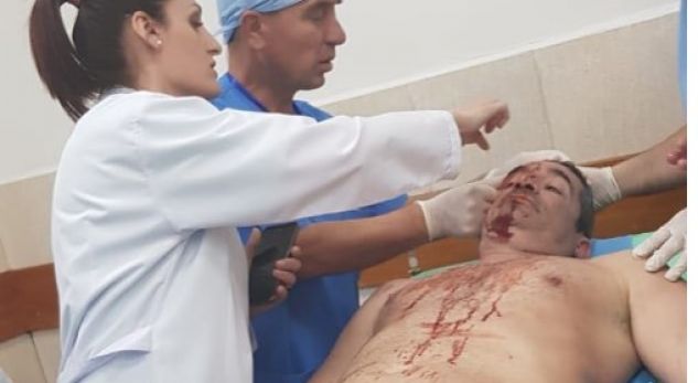 Përplasja me policinë/ Gjakoset gazetari (FOTO)