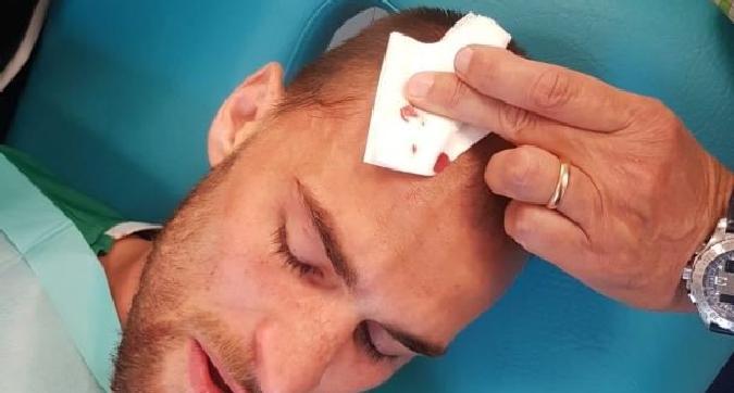 Ultrasit e Sportingut dhunojnë lojtarët, plagosen disa prej tyre