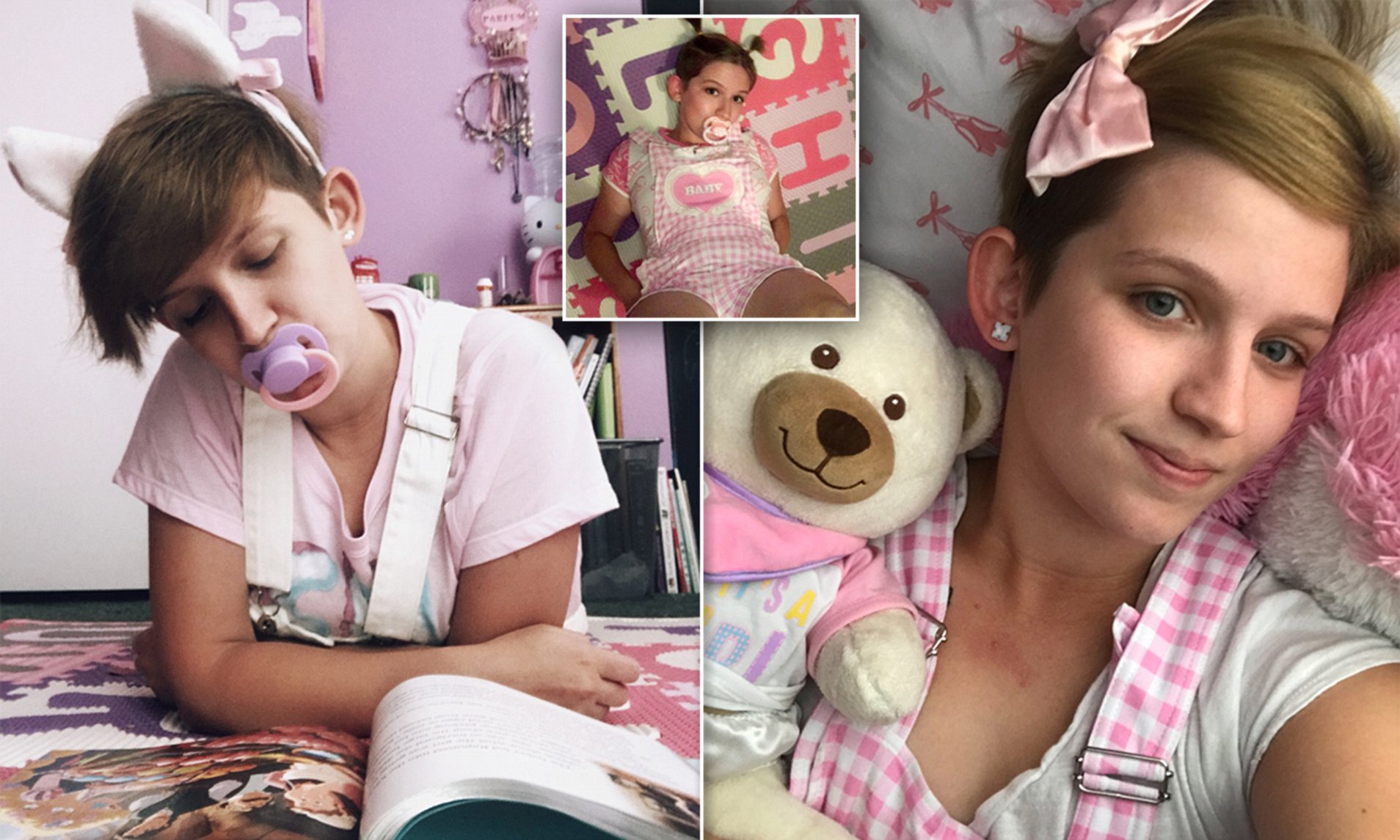 24-vjeçarja që vishet e sillet si foshnje për të shmangur problemet e të rriturve