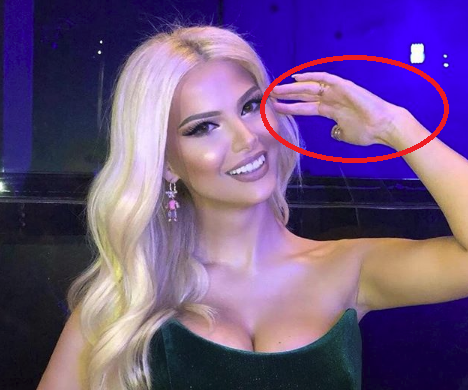 Marina Vjollca “pret” gishtin e dorës (FOTO)