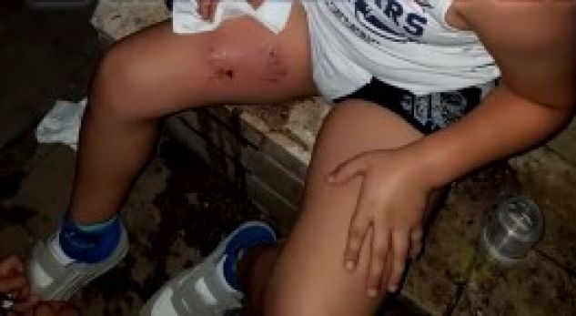 Pitbulli kafshon fëmijën 8-vjeçar në mes të qytetit (FOTO)