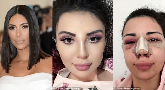 Modelja shpenzon mijëra dollarë për t’u bërë si Kim Kardashian (FOTO)