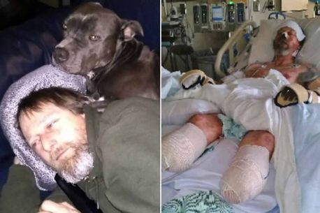 E dhimbshme/ Humbi krahët dhe këmbët nga veprimi i dashur i qenit