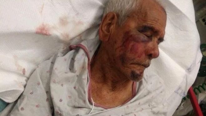 &#8220;Kthehu në vendin tënd&#8221;, gruaja sulmon rëndë të moshuarin