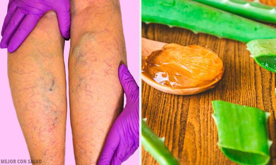 Xheli mrekullibërës i Aloe Verës, një aleat i vyer për bukurinë tonë