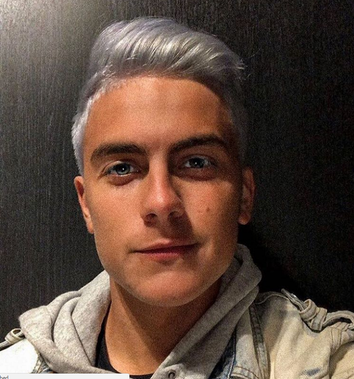 “Çmendet” Dybala, e pret Ronaldon me flokë të bardhë