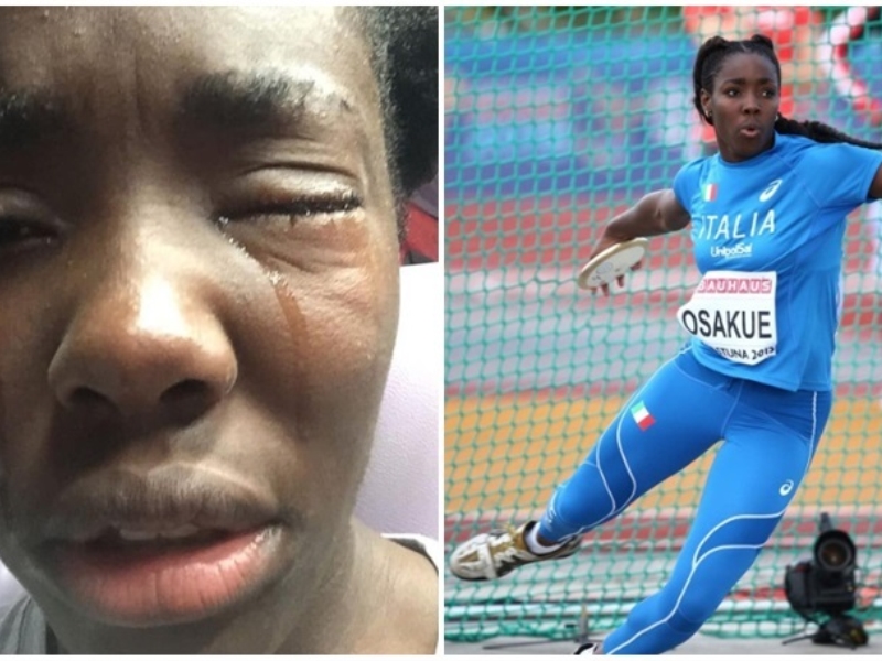 Italia tronditet nga sulmi racist