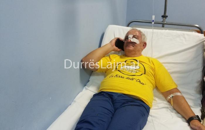 FOTO/ Me fasho në hundë, si është dhunuar avokati në Durrës