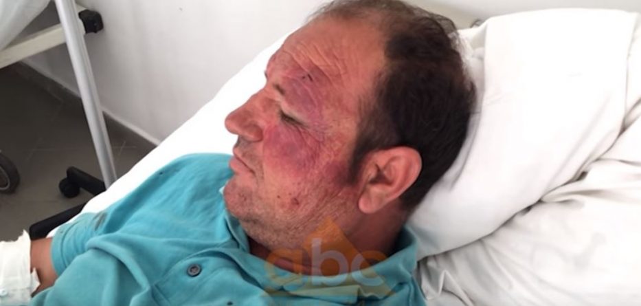 “Piratët” bëjnë për spital taksistin në Vlorë