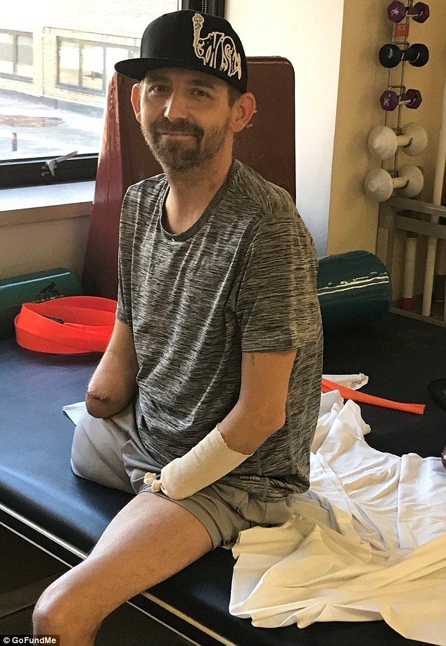 Rast i frikshëm/ Bakteri i ha mishin…mbetet pa këmbë dhe duar (FOTO)