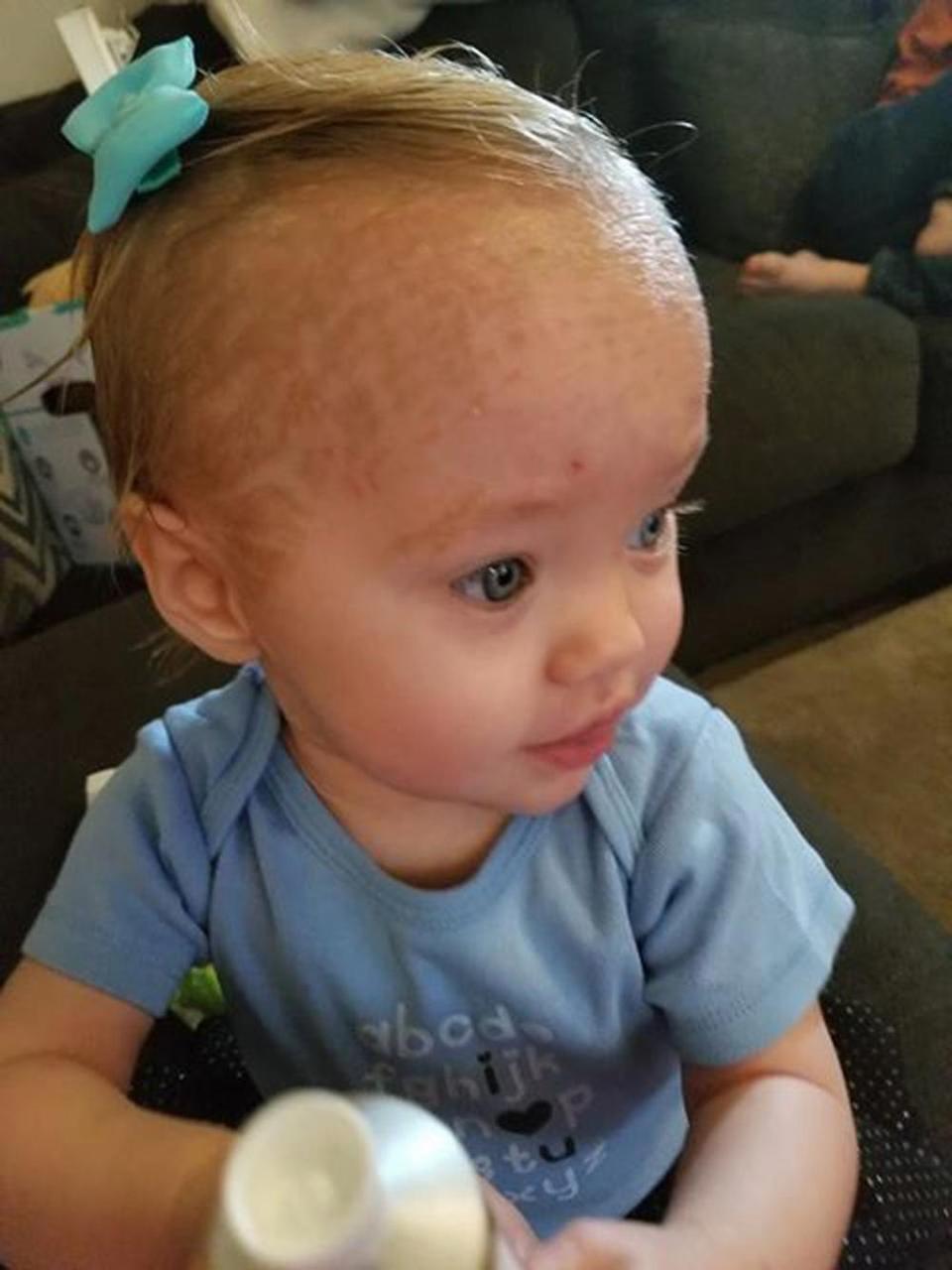 Nëna lan foshnjen me zbardhues!