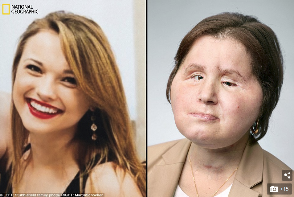 “M’u dha një shans i dytë për të jetuar”