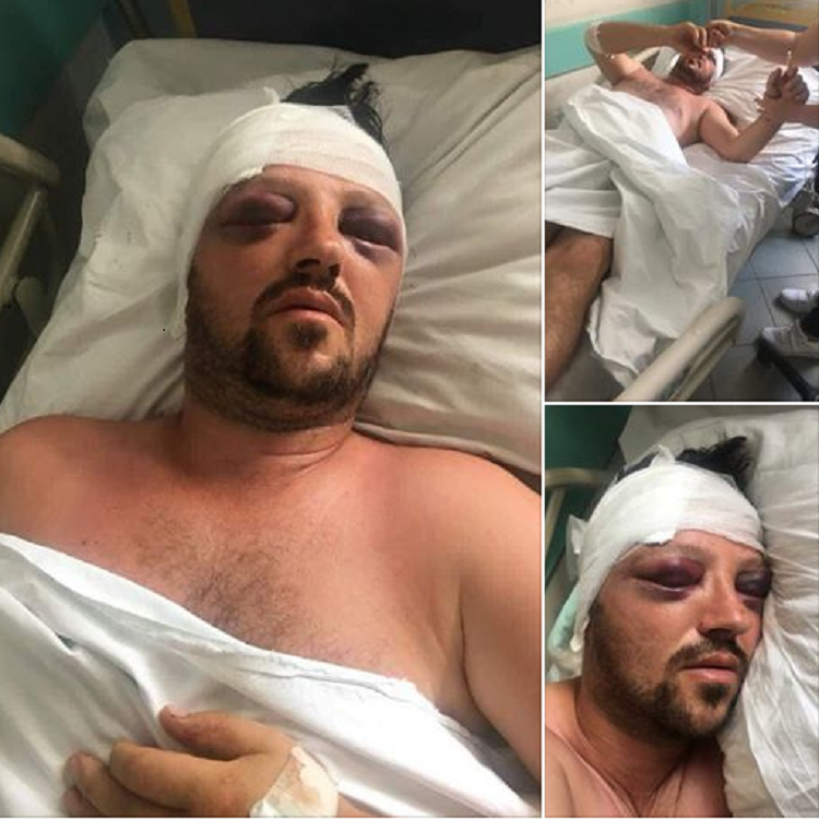 FOTO/ Vrapoi të shpëtonte qenin por e përplasi treni në Durrës. 39-vjeçari me plagë të rënda