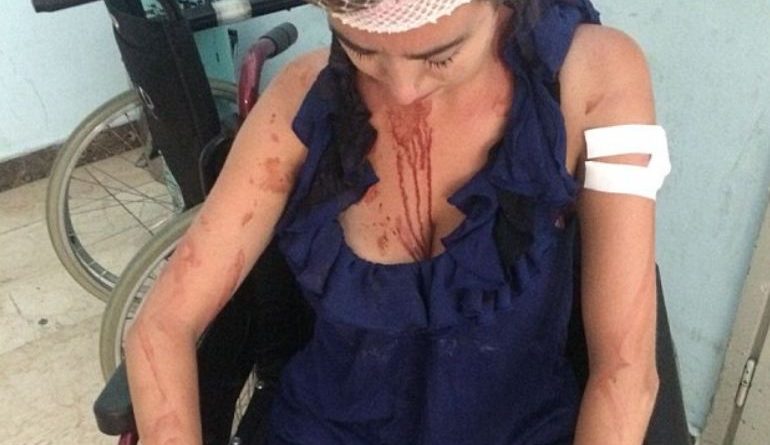 Refuzoi çmimet e “kripura”, studentja 26-vjeçare rrihet nga pronari i hotelit