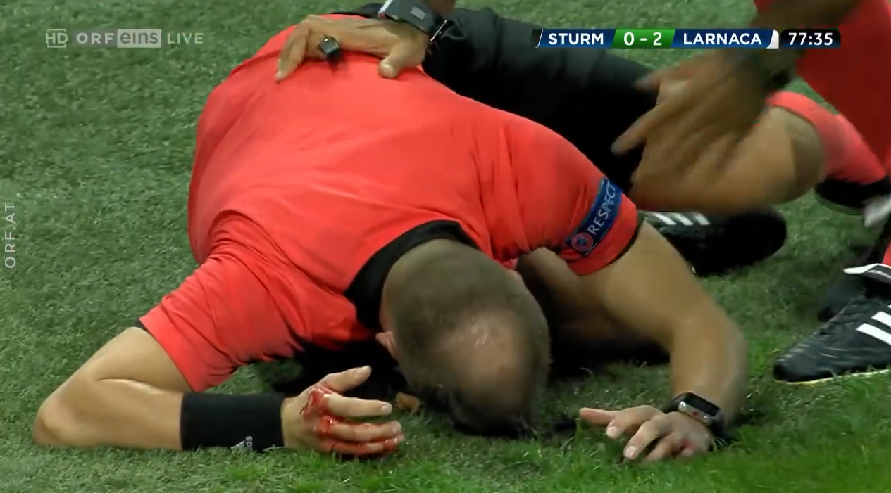 Ndodh edhe në Austri, anësori gjakoset nga tifozi (VIDEO)