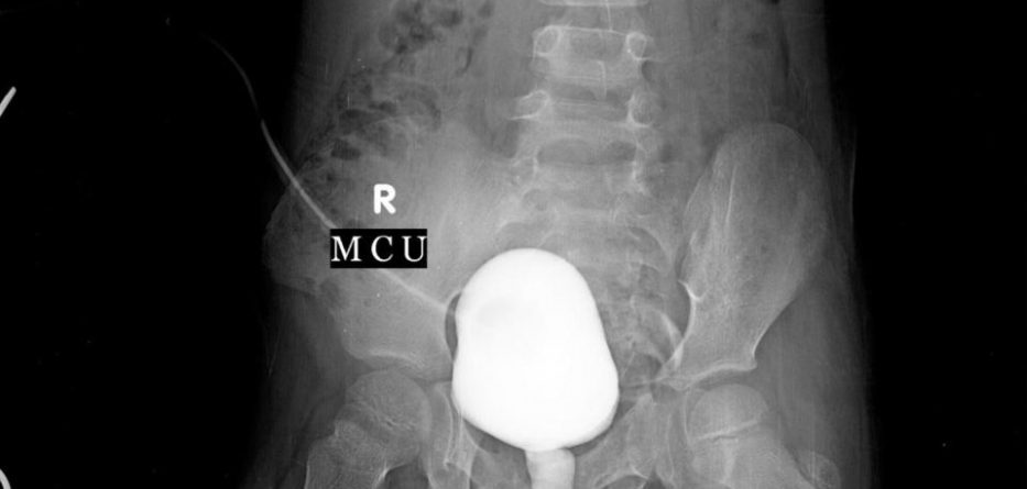 Mjekët bëjnë një zbulim shokues në organet e 6-vjeçarit (FOTO)