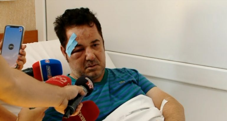 Biznesmeni i dhunuar rrëfen si e masakroi banda: Po paguaj për borxhet e …