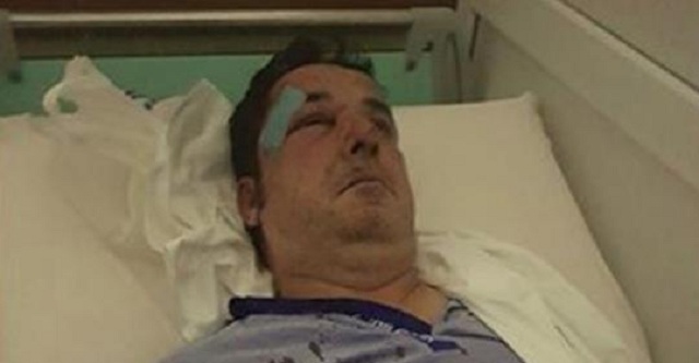 Plagë në kokë e trup, biznesmeni dhunohet pranë shtëpisë (EMRI)