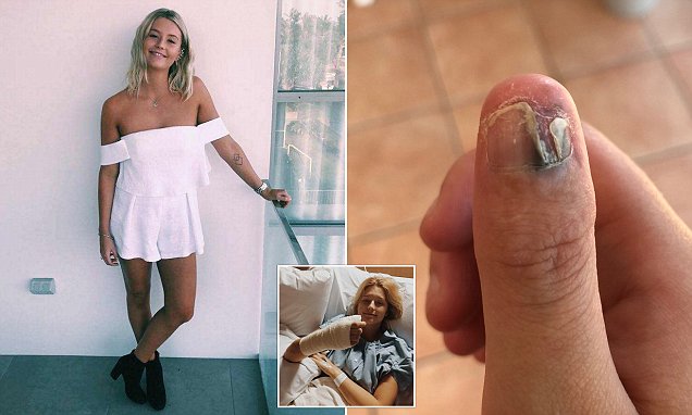 Kafshimi i thonjve për pak sa nuk i kushtoi jetën (FOTO)