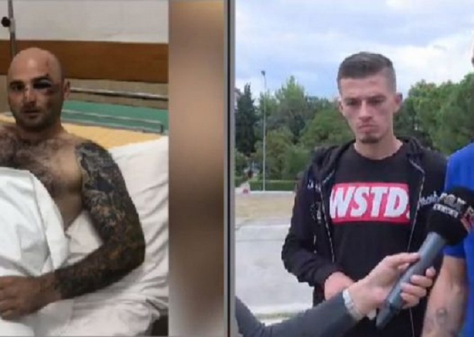 Stresi flet për mikun e plagosur nga policia: I thanë pusho se të vramë