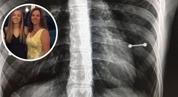 Mamaja shokohet kur grafia i zbulon sekretin e vajzës (FOTO)