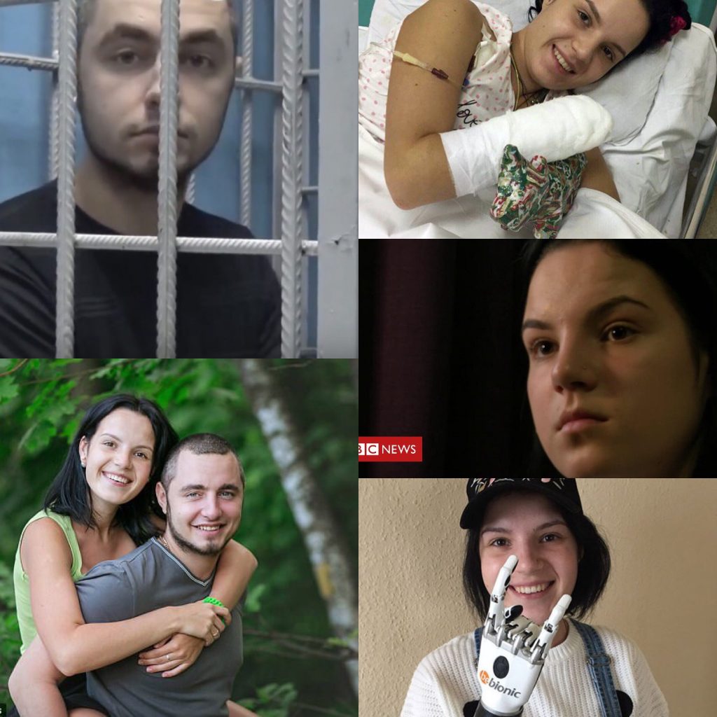 “Më çoi në pyll dhe më preu duart me sëpatë”, 27-vjeçarja rrëfen sulmin e tmerrshëm