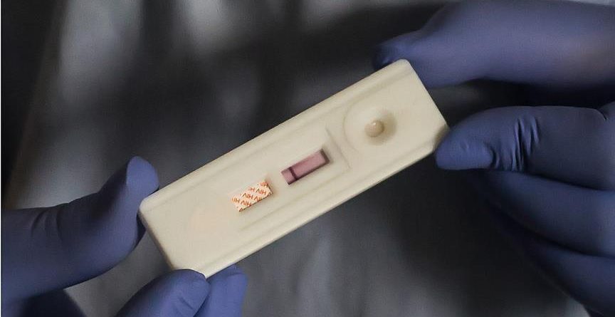 9,4 milionë njerëz në botë nuk e dinë që janë të infektuar me HIV