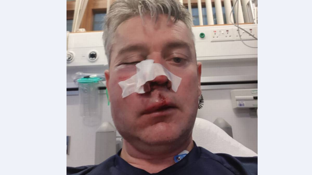 Ja si u masakrua gjyqtari në Irlandë, dyshohen tre futbollistë