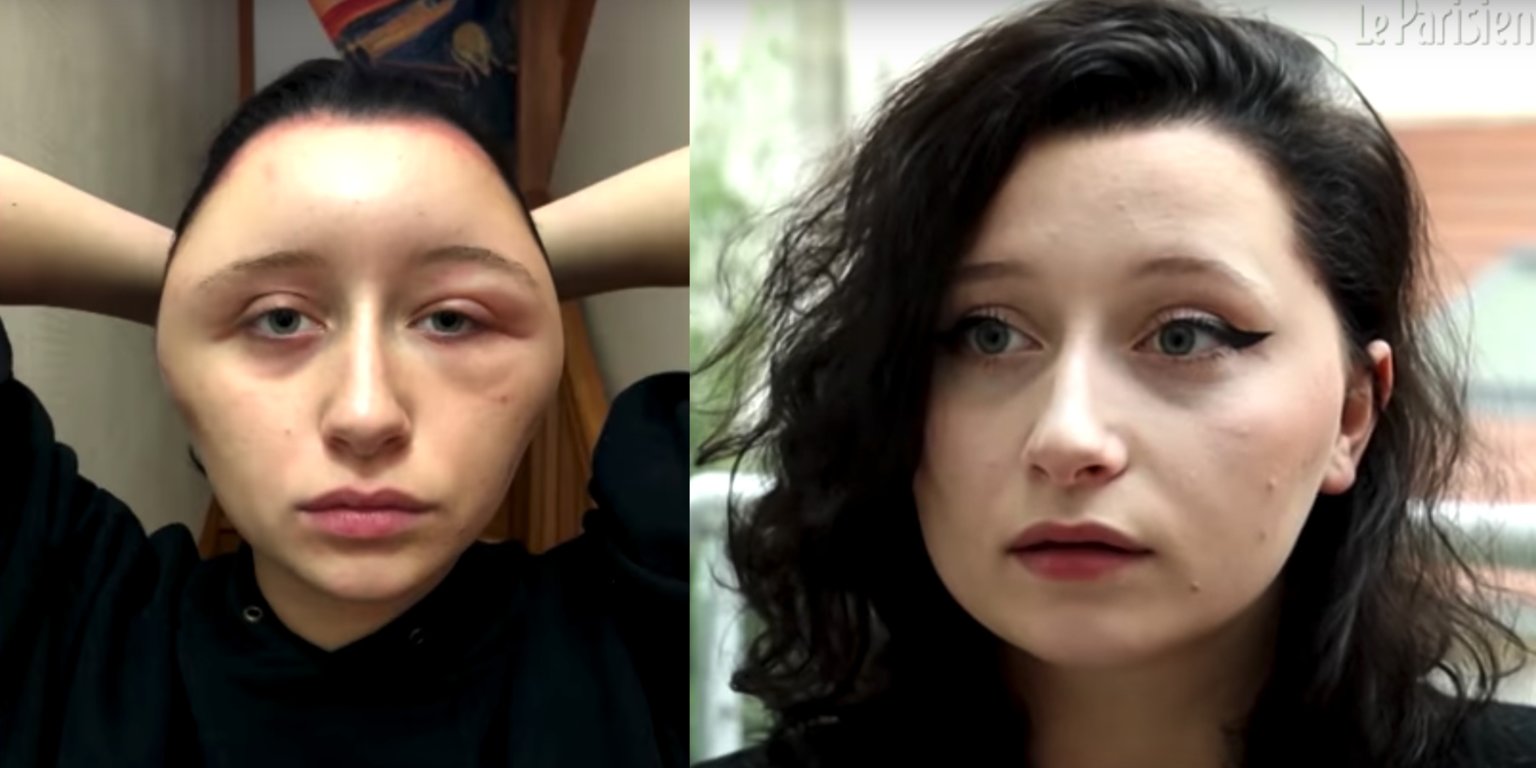 I deformohet fytyra nga boja e flokëve! (FOTO)