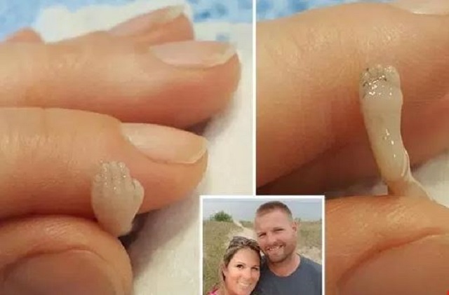 Nëna publikon fotografitë e djalit 14 javësh