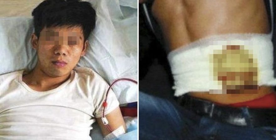 7 vite më parë shiti veshkën për të blerë iPhone, sot…