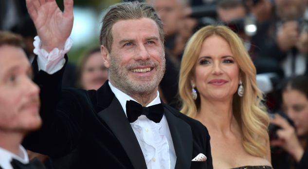 Aktori i famshëm shfaqet tullac, deri tani kishte mbajtur parukë! (FOTO)