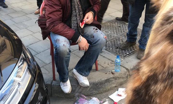 Grabitet kambisti në Tiranë, goditet me sende të forta (FOTO)